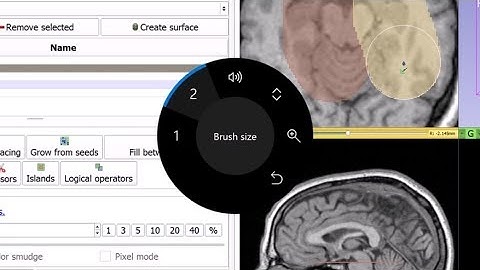 Controlling 3D Slicer using Surface Dial