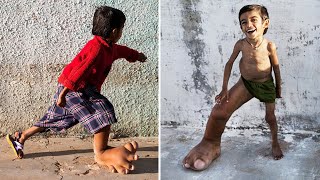 This Unique Kid was Born With a Unique Feature that Shocked the World