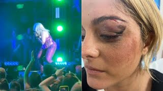 celebrities getting hit by flying objects (Bebe Rexha, Ava Max,....)