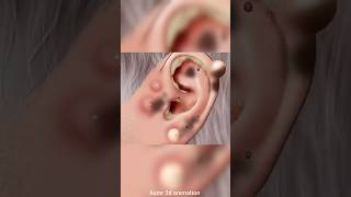 ear cleaning asmr #animationtreatment #earwaxremoval #earcleaning #asmrvideos