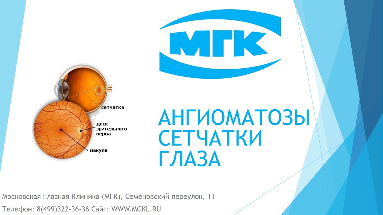 Ангиоматозы сетчатки глаза (болезнь Гиппеля-Линдау, цереброретинальный ангиоматоз)