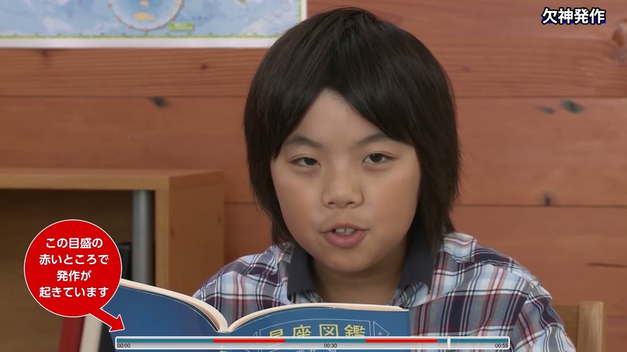 欠神発作(定型欠神発作、非定型欠神発作)｜ユーシービージャパン株式会社／UCB Japan