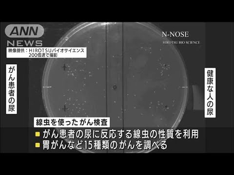 尿1滴で・・・線虫がん検査の拠点が新宿にオープン(2021年7月21日)