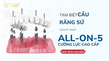 Tạm Biệt Cầu Răng Sứ – Giải Pháp All-on-5 Phục Hồi Răng Toàn Hàm