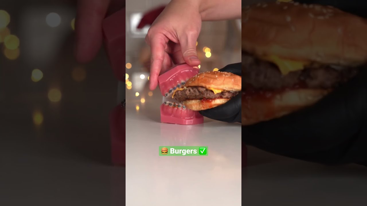 Braces Vs Food Five Guys Edition W The Doc