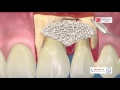 Diş eti hastalıkları ve cerrahisi uzmanı Dr. Burak Hamzaçebi