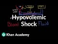 Understanding Hypovolemic Shock