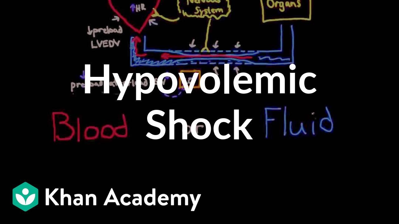 Blood Loss Shock Chart