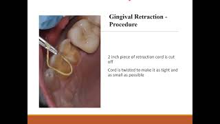 SOFT TISSUE MANAGEMENT IMPRESSION TECHNIQUES IN FPD