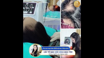 Ai #rụng tóc lâu năm đến Anila trị dứt điểm chỉ 1 liệu trình !