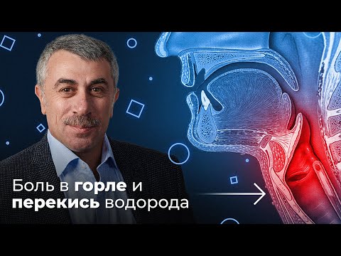 ШДК: Боль в горле. Перекись водорода - Доктор Комаровский