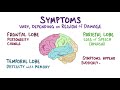 Vascular dementia   causes, symptoms, diagnosis, treatment, pathology