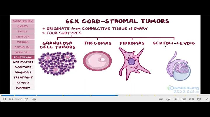 Ovarian cysts and tumors: Pathology review