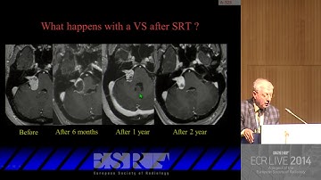 H&N RC 1108   Skull base lesions   Imaging studies and differential diagnosis 3