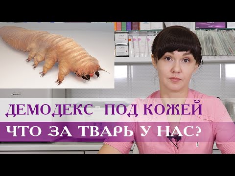 Video: Demodex Brevis: Struktur, Hvordan Behandle, Symptomer