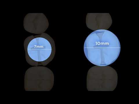 SMARTLITE PRO EMBOUT DE POLYMERISATION