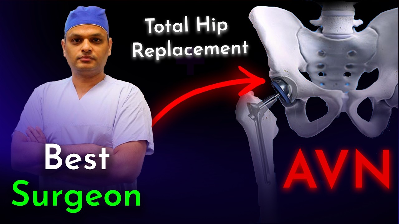 हिप रिप्लेसमेंट | Total Hip Relpacement | कूल्हे खराब होने पर क्या करें? | THR | AVN| Hip Arthritis