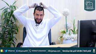 مواضع حجامة النافوخ أو اليافوخ | مركز وقاية للحجامة بالكويت | الحجامة في الكويت | alhijamaa.com