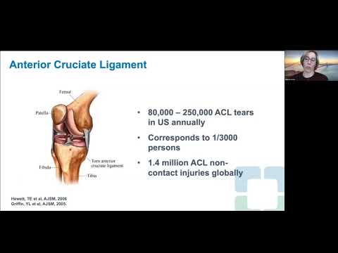 The Impact of ACL Function on Knee Biomechanics and PTOA Risk by Phd Jillian Beveridge