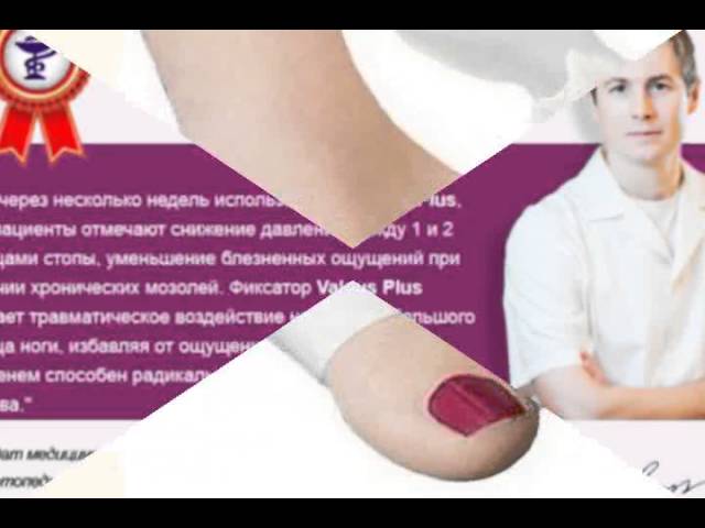 Гелевые Фиксаторы Valgus Pro