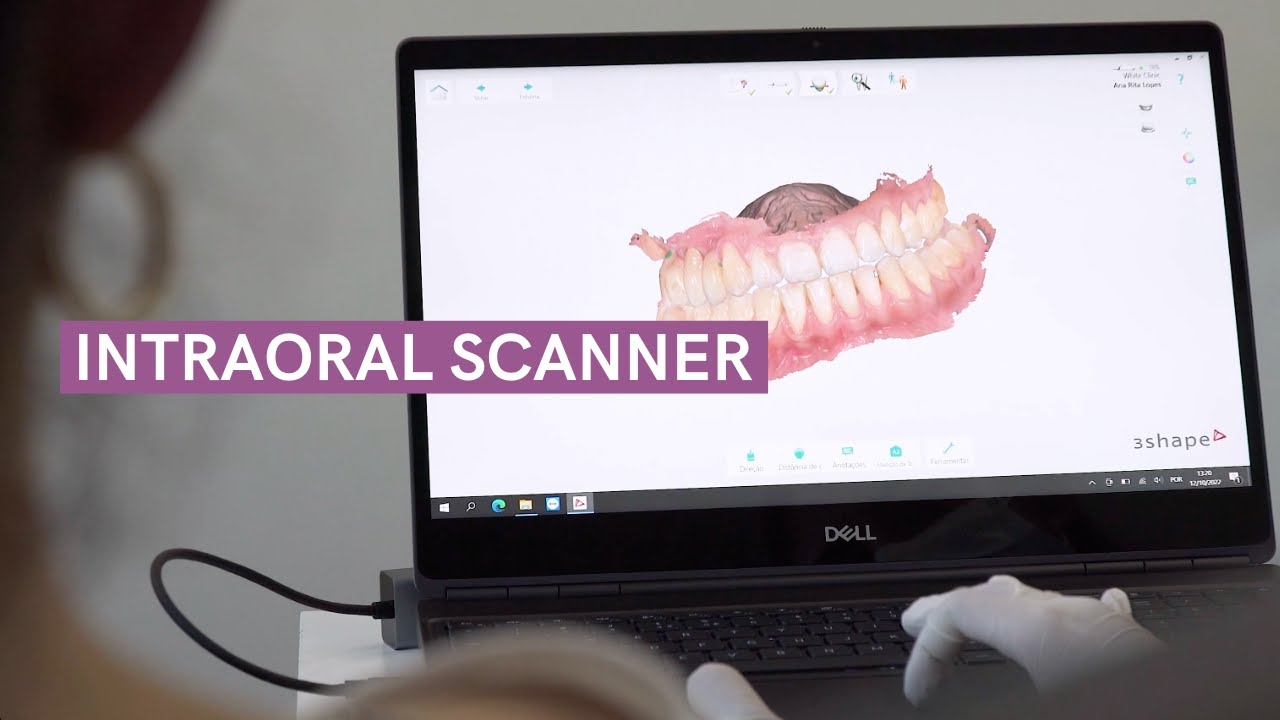 White Clinic #Tech | Intraoral Scanner | Always connected