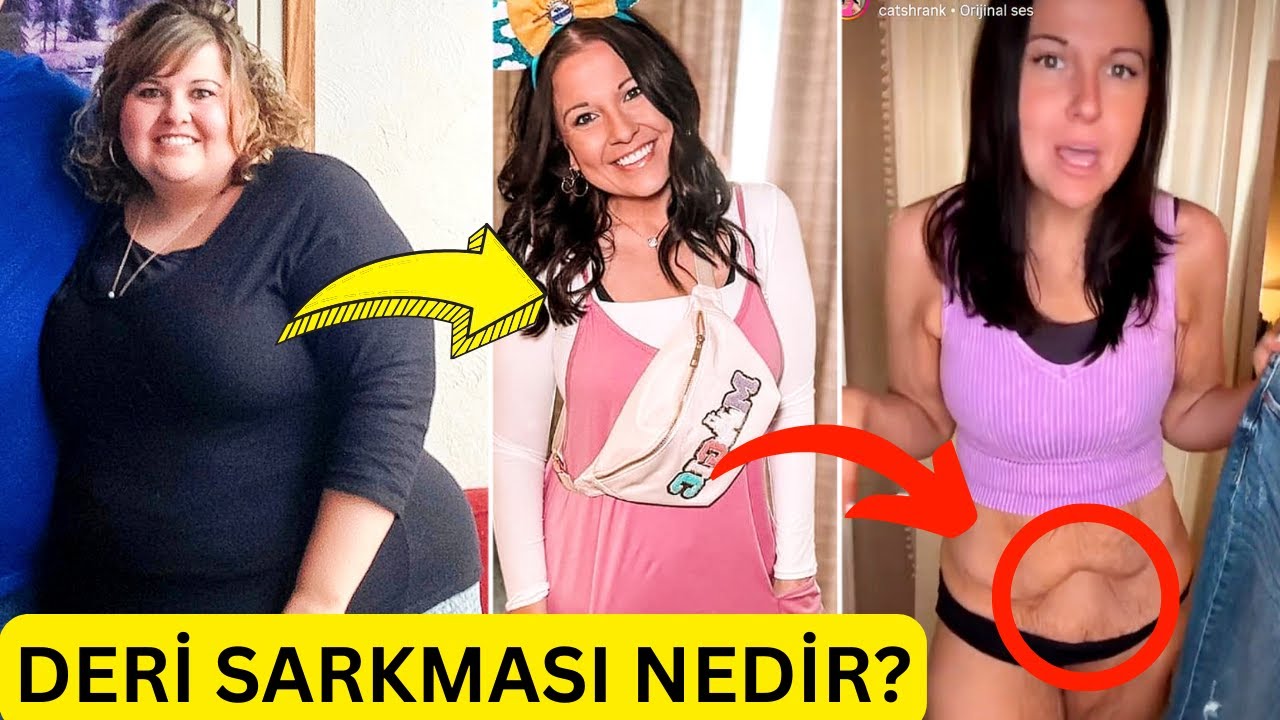 Nurgul Yeshilchay bilan jinsiy aloqa