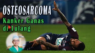 Osteosarcoma  Kanker Ganas Di Tulang