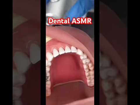 Dental ASMR 🦷#amsr #asmrcommunity #dentalasmr #oddlysatisfying #viral #asmrmouthsounds #asmrfr #fyp