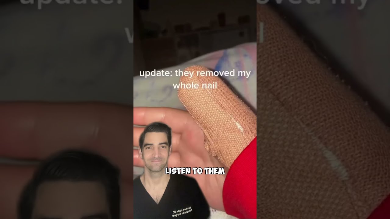 Finger Swelling