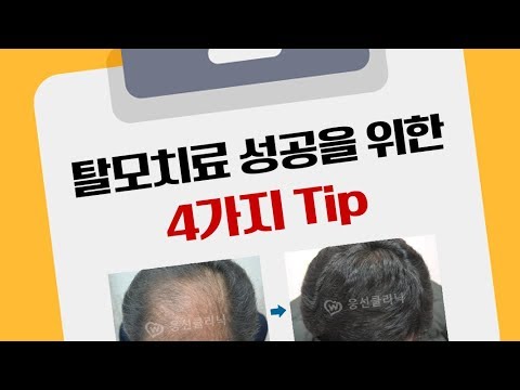 (21강) 탈모치료 성공을 위한 4가지 Tip