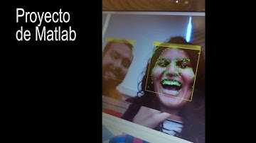 Baxter, Matlab & Kuka