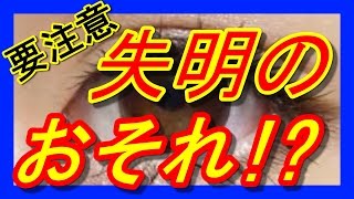 【衝撃】要注意!!「不同視」失明の恐れも…!?