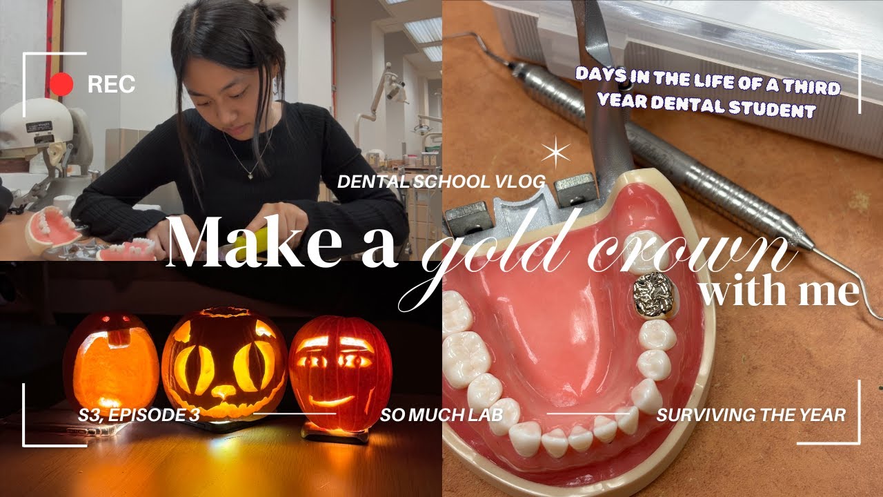 MAKE A GOLD TOOTH WITH ME 👑 | days in the life of a third year dental ...