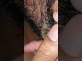 ASMR  #massage therapy #satisfying #beard #skincare #haircare #ingrownhair #shorts #video