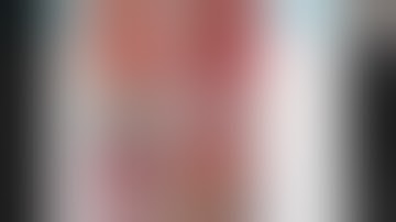 Cisternostomy How do I Do It?