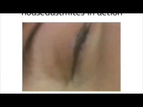 House Dust Mites in Action