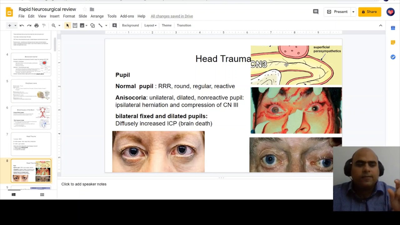 Rapid Neurosurgical Review By Hatem B Afana مراجعة سريعه في جراحة الاعصاب حاتم عفانه