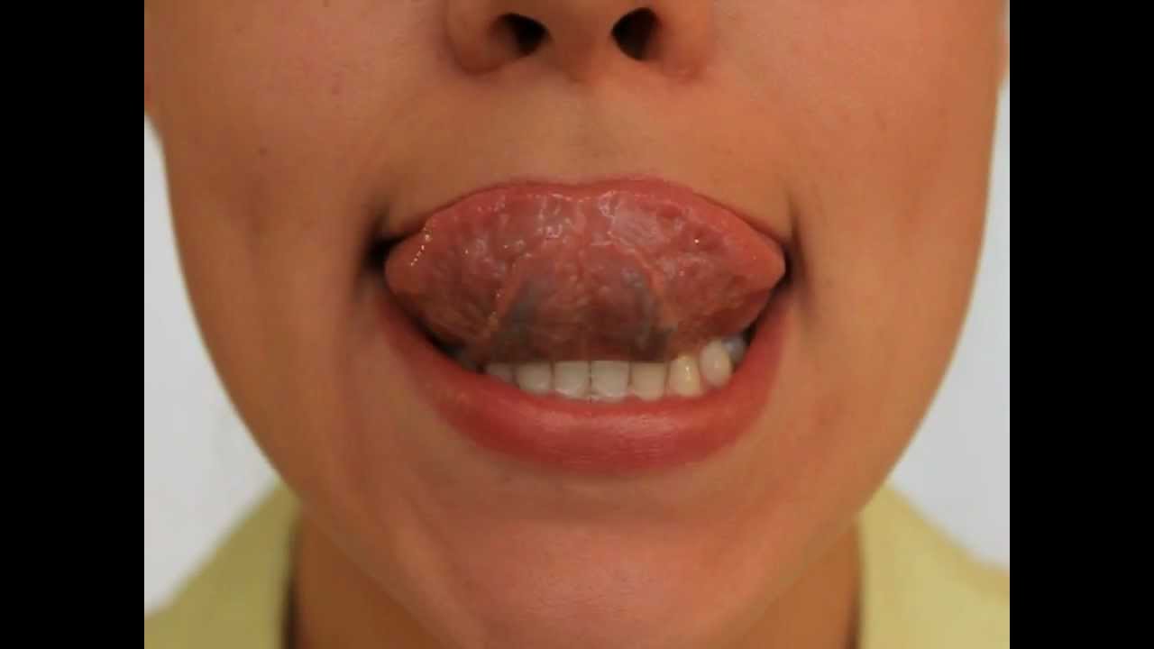 Рот шире губ
