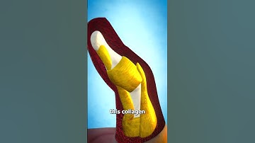 Thumbnail of What Is Hitchhiker's Thumb? 👍