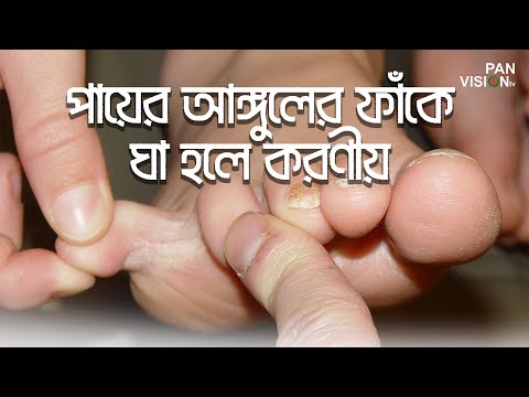 ভিডিও: দুধে ব্যাঙের পা ভিজিয়ে রাখো কেন?