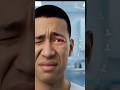 What is Red Eye (Pink Eye)? Causes, Symptoms & Most Common Reason Explained | Conjunctivitis