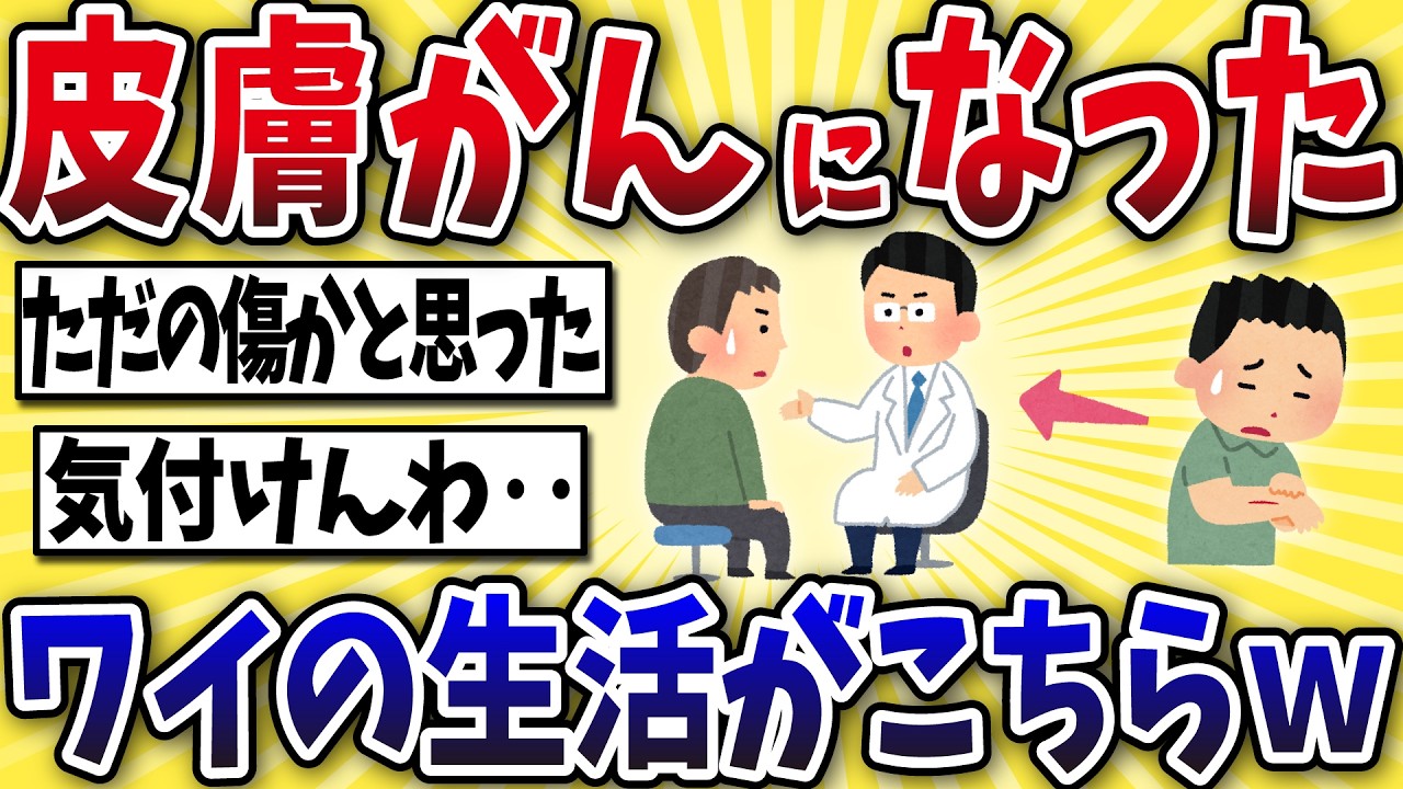 【要注意】皮膚がんになったワイの生活がこちら・・・【2ch風解説】
