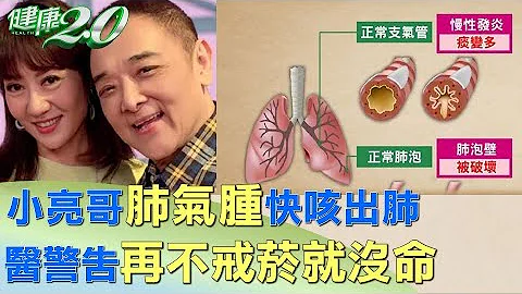 小亮哥肺氣腫快咳出肺 醫警告再不戒煙就沒命 健康2.0 @tvbshealth20 - 天天要聞