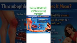 thrombophlebitis ll #nurse #nursing #question #nonfollowers #bscnursing #followme