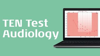 Threshold Equalizing Noise (TEN) Test Procedure