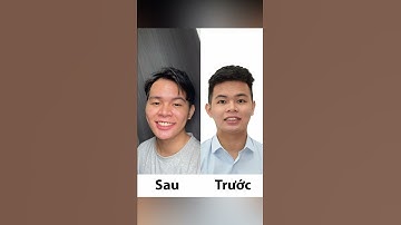 Review hành trình tháo niềng răng tại Up Dental