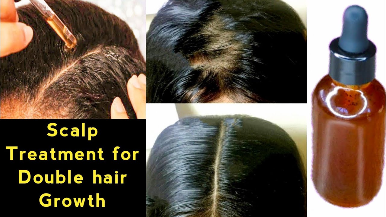 How to grow hair very fast in a week/scalp treatment for hair growth at