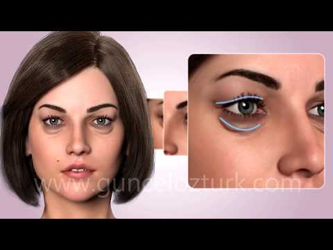 Cosmetic