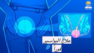 علاج البواسير ٣ طرق لتهدئتها و التخلص منها بدون ألم بعد اليوم