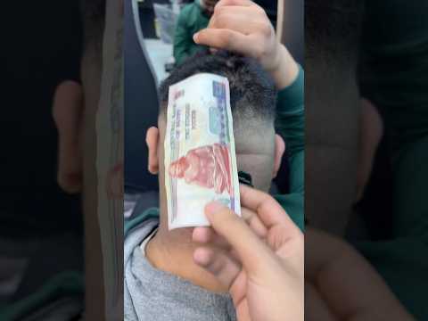 ازالة الحباية المتسلطنة من الجمجمه       